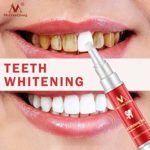 YJYdada Teeth Whitening Gel Pen Quick Remove Stain Yellow Teeth Whitening White Pen