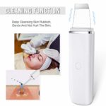 Koi Beauty Ultrasonic Skin Scrubber Face Spatula,Blackhead Remover Pore Cleaner,Facial Scrubber Spatula,Exfoliator Rechargeable Face Lifting Tool