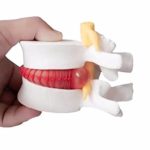 OUBO DENTAL White Color Oral 1:1.5 Anatomical Human Lumbar Vertebrae Degenerative Lumbar Human Spine Model US Stock